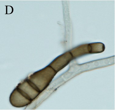 链格孢菌分生孢子.jpg